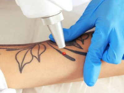 “آیا خالکوبی جرم است”؟